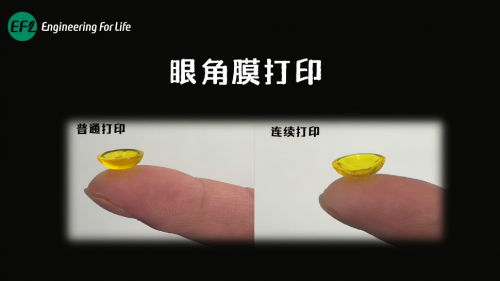 眼角膜打印