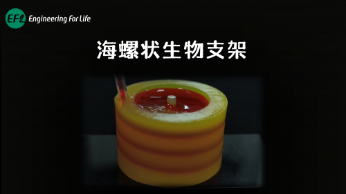 海螺状生物支架