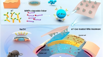 ACS Nano：MMP响应型aT−Exo微针，为角膜碱烧伤提供抗炎与修复双靶点治疗